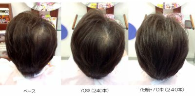 フェルモ:つむじ割れ:70束+70束