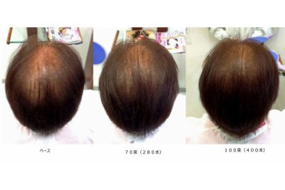 フェルモ:増毛3ステップ:260束ステップ1