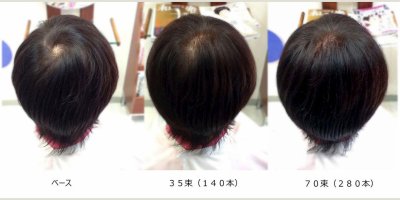 フェルモ:つむじ割れ:70束