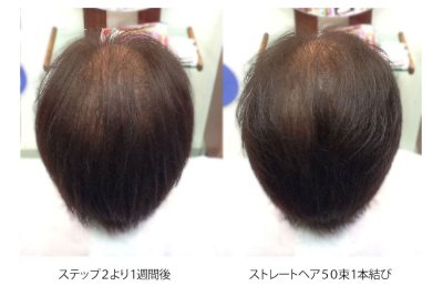 フェルモ:増毛3ステップ:260束ステップ3