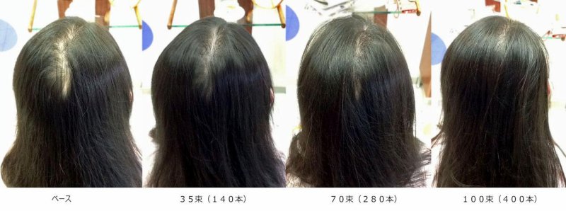 フェルモつむじ割れ:100束(400本)